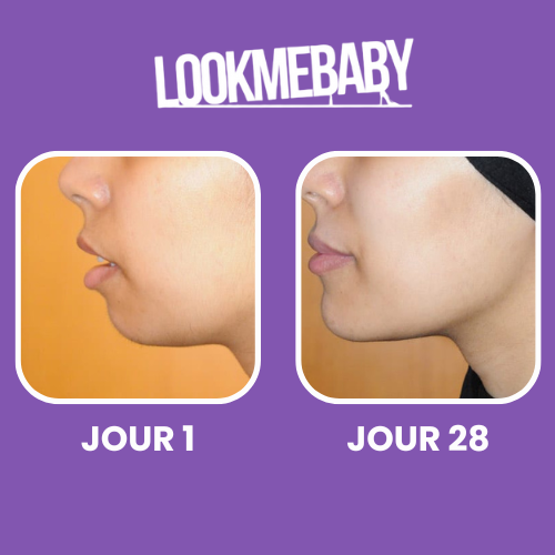 LookMeBaby® – Dites Adieu à votre Double Menton, Naturellement